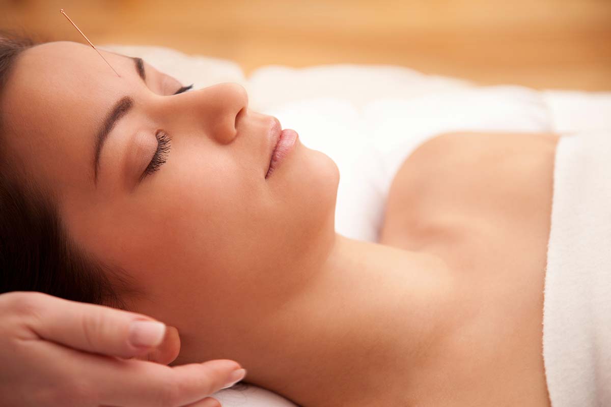 woman laying down getting acupuncture as part of naturopathy for addiction treatment